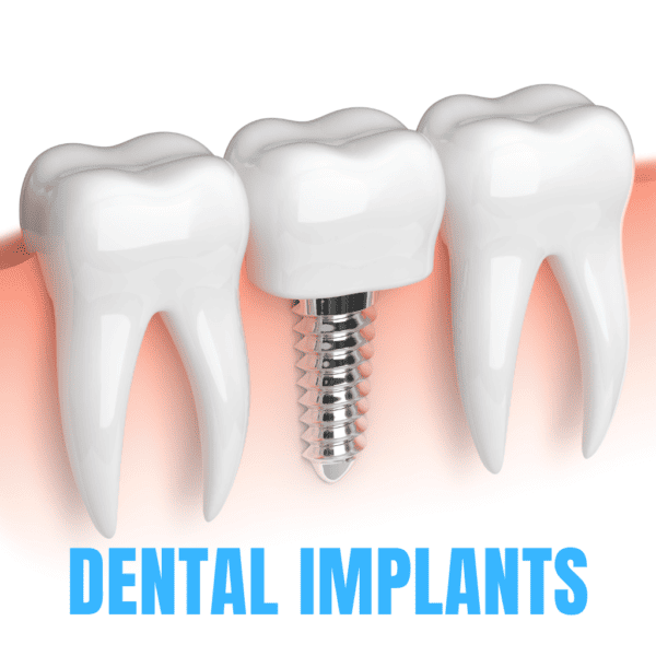 Best Dental Implant in Pitampura Restore Your Smile with Dr. Mallick Dental​​
