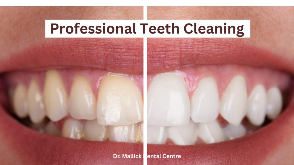 The Benefits of Professional Teeth Cleaning