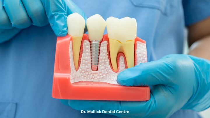 Root Canal Treatment – Painful or Painless?