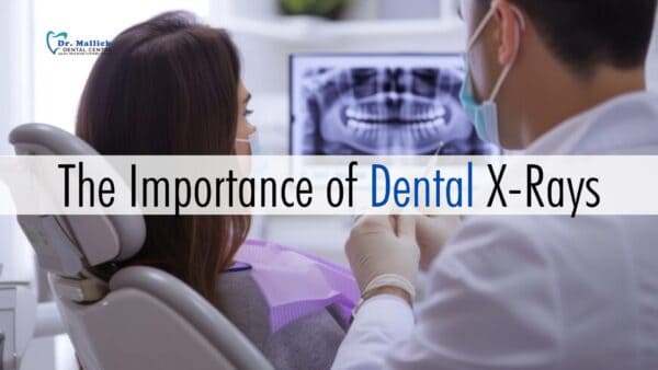 The Importance of Dental X-Rays – And Are They Safe?