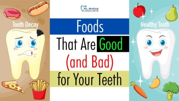 Foods That Are Good (and Bad) for Your Teeth