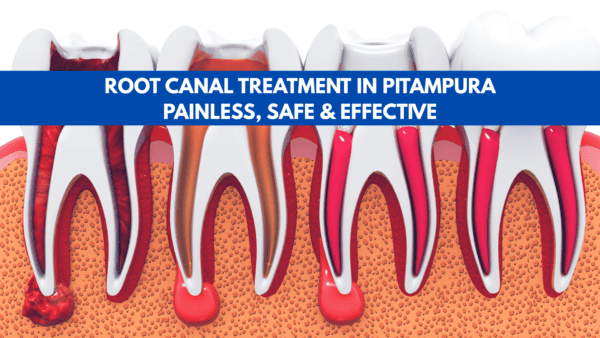 Root Canal Treatment in Pitampura – Painless, Safe & Effective