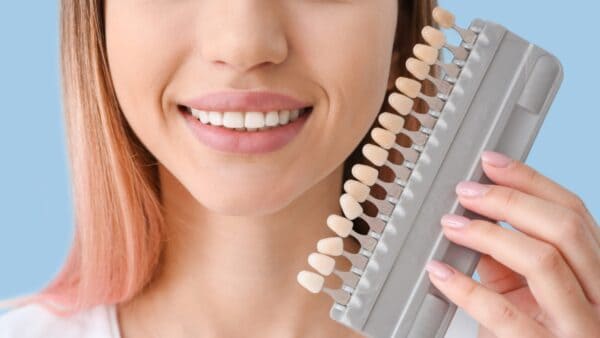 Dental Veneers in Pitampura – Transform Your Smile with Precision
