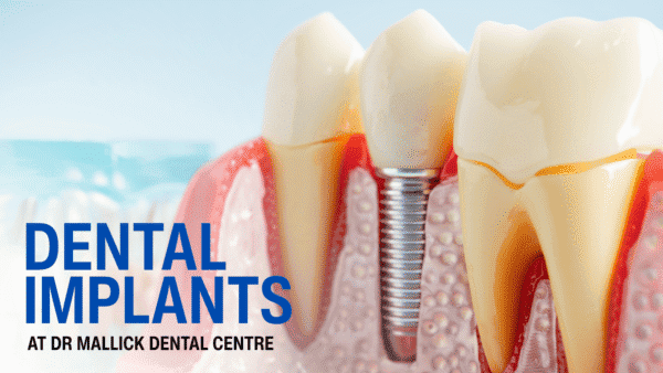 Dental Implants in Pitampura – Permanent Tooth Replacement at Dr. Mallick Dental Centre Dental Implants in Pitampura – The Permanent Solution for Missing Teeth