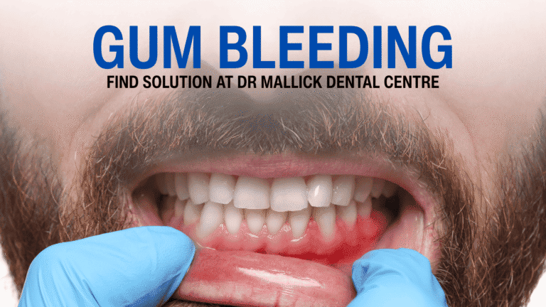 Gum Bleeding Treatment in Pitampura – Warning Signs You Should Never Ignore