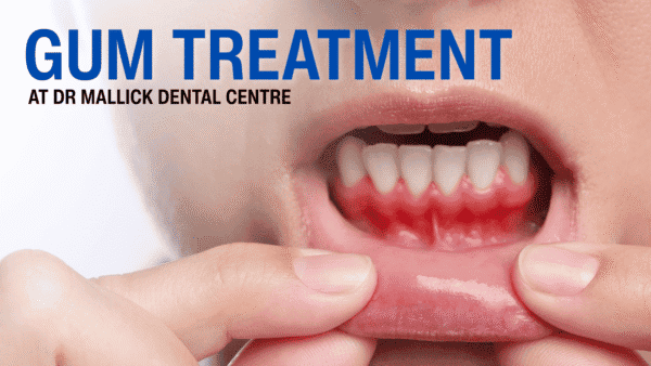 Gum Surgery in Pitampura – Advanced Gum Treatment at Dr. Mallick Dental Centre Gum Surgery in Pitampura – When Is It Needed and What to Expect