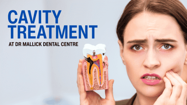 Cavities Treatment in Pitampura – Stop Tooth Decay Before It Gets Worse