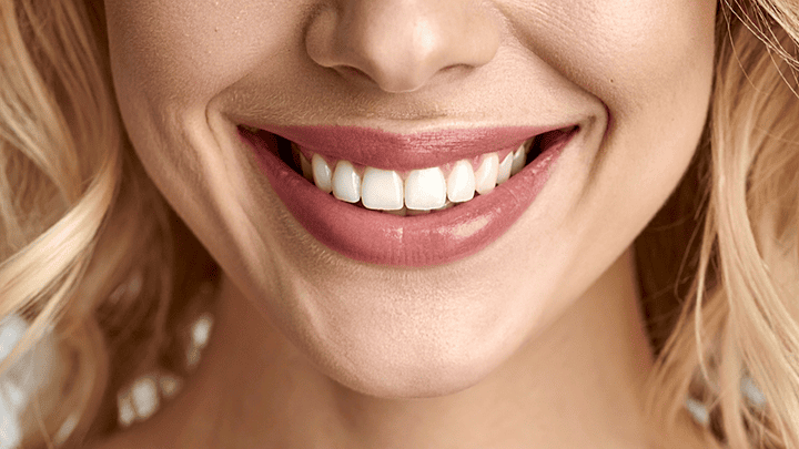 Smile Makeover in Pitampura – Transform Your Smile with Cosmetic Dentistry