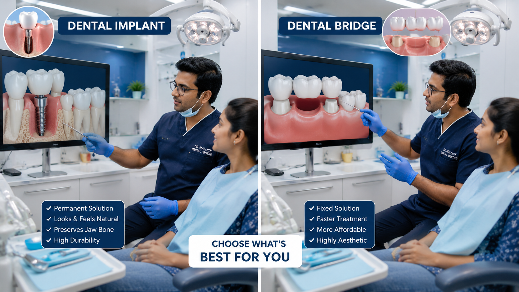 Dental Implants vs Dental Bridges – Which Tooth Replacement Option Is Better?